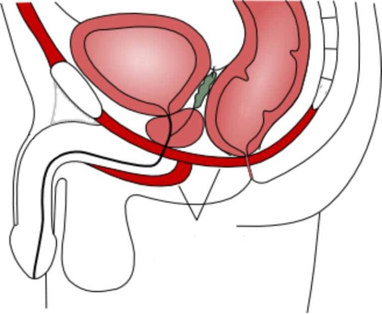 Training the pelvic floor muscles to improve potency